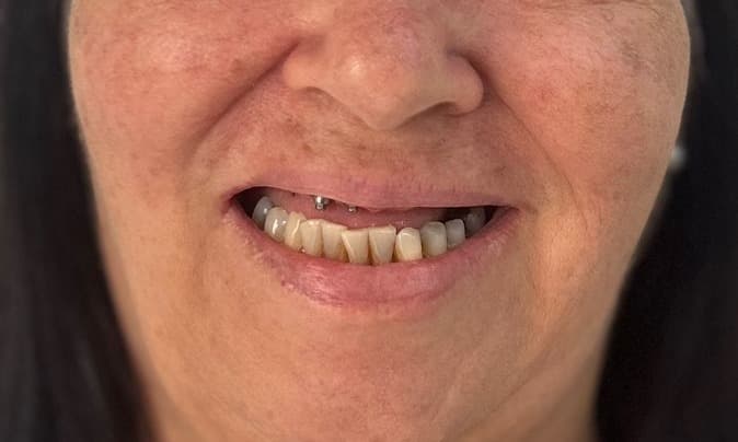 Sorriso antes do tratamento